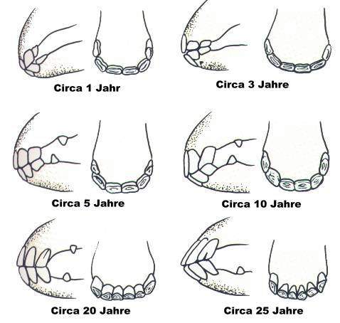 Veränderung der Zahnstellung